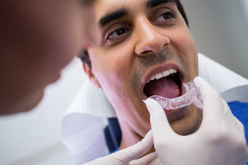 Invisalign: A Journey to Enhanced Oral Hygiene and Overall Confidence